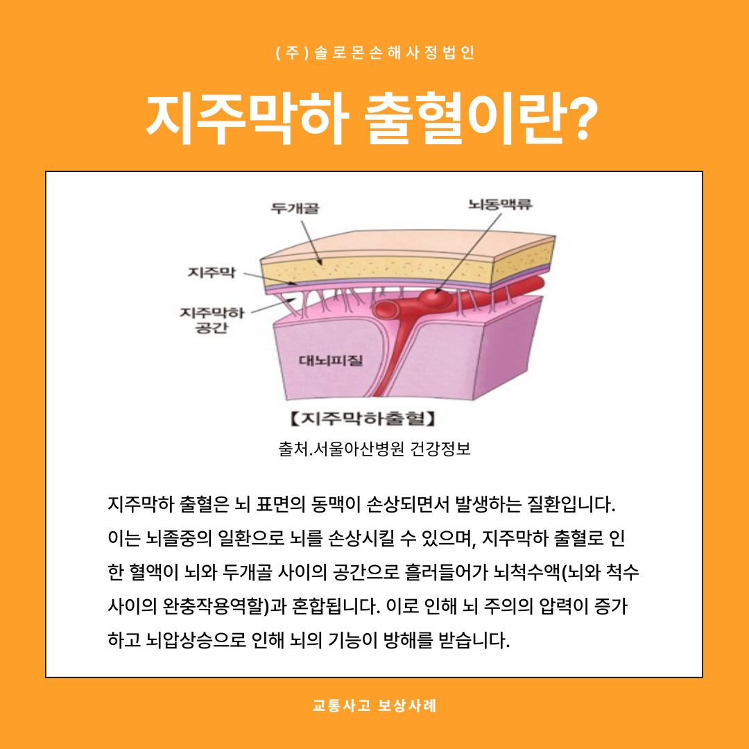 지주막하출혈I60 뇌출혈진단비 손해사정 도움이 필요한 경우