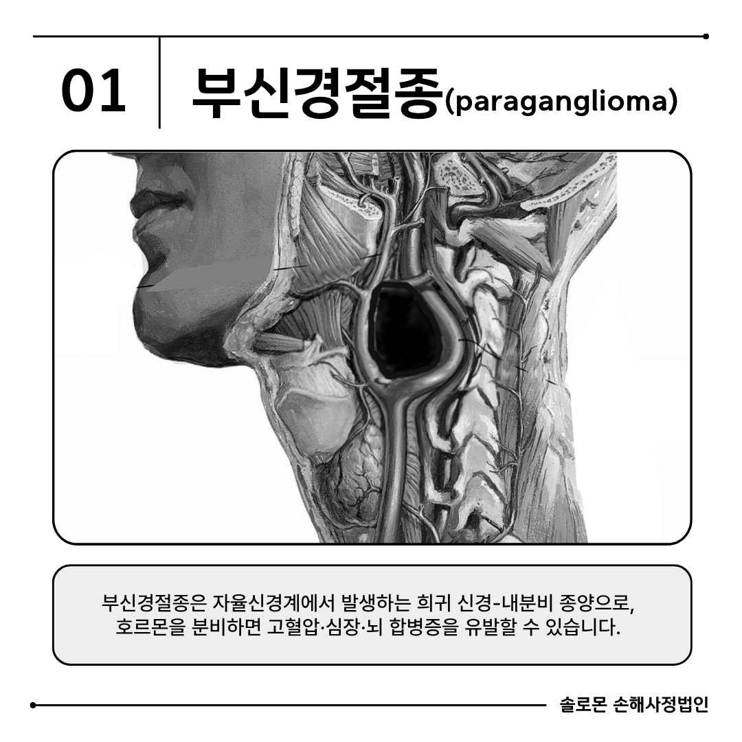 부신경절종(paraganglioma) 암진단비 보상 분쟁 이유