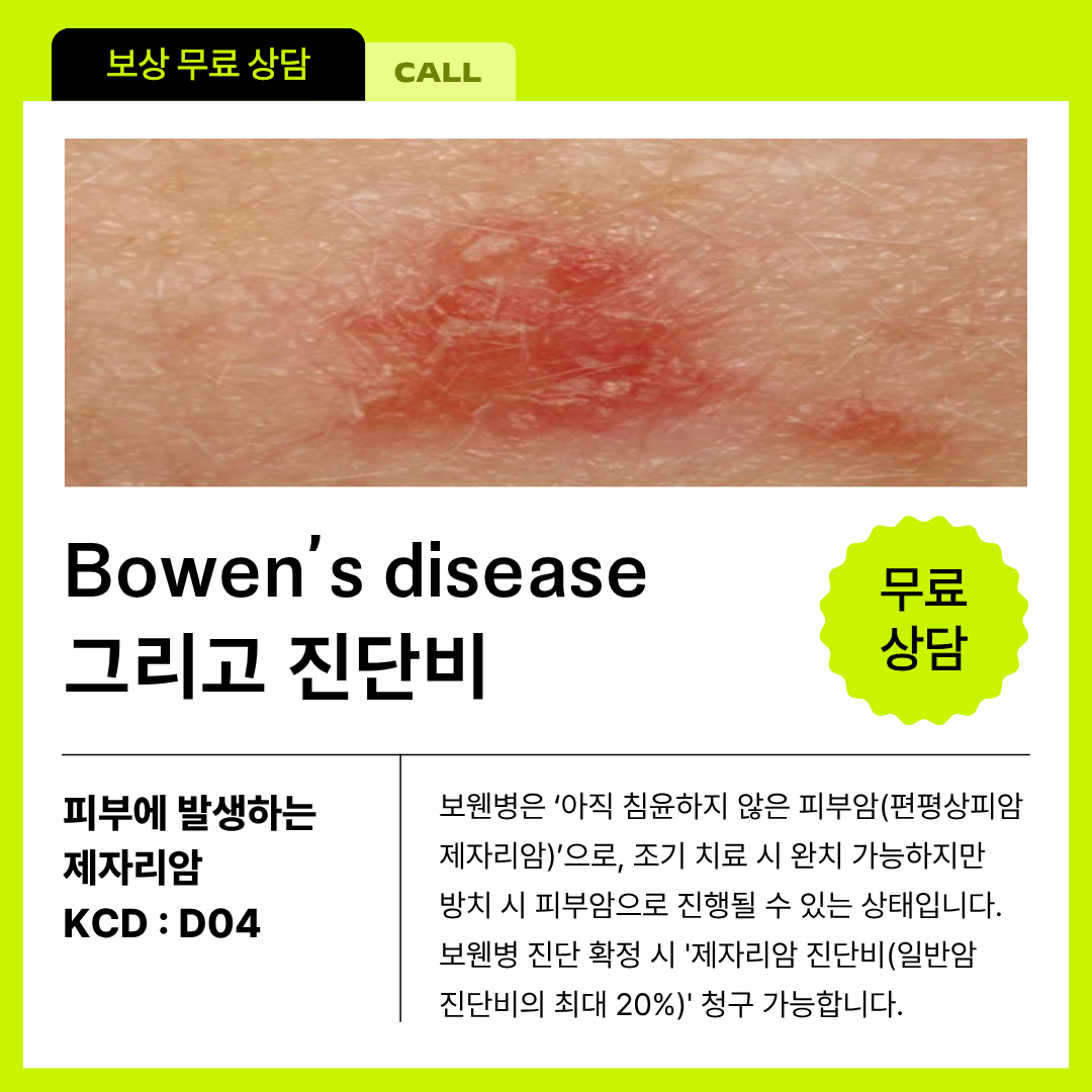보웬병 bowen disease 소견에도 피부질환 진단을 받았다면