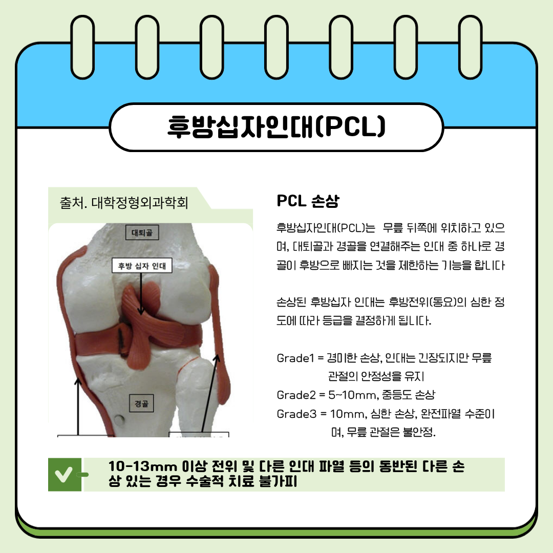 PCL rupture 파열 후유장해 보상포인트