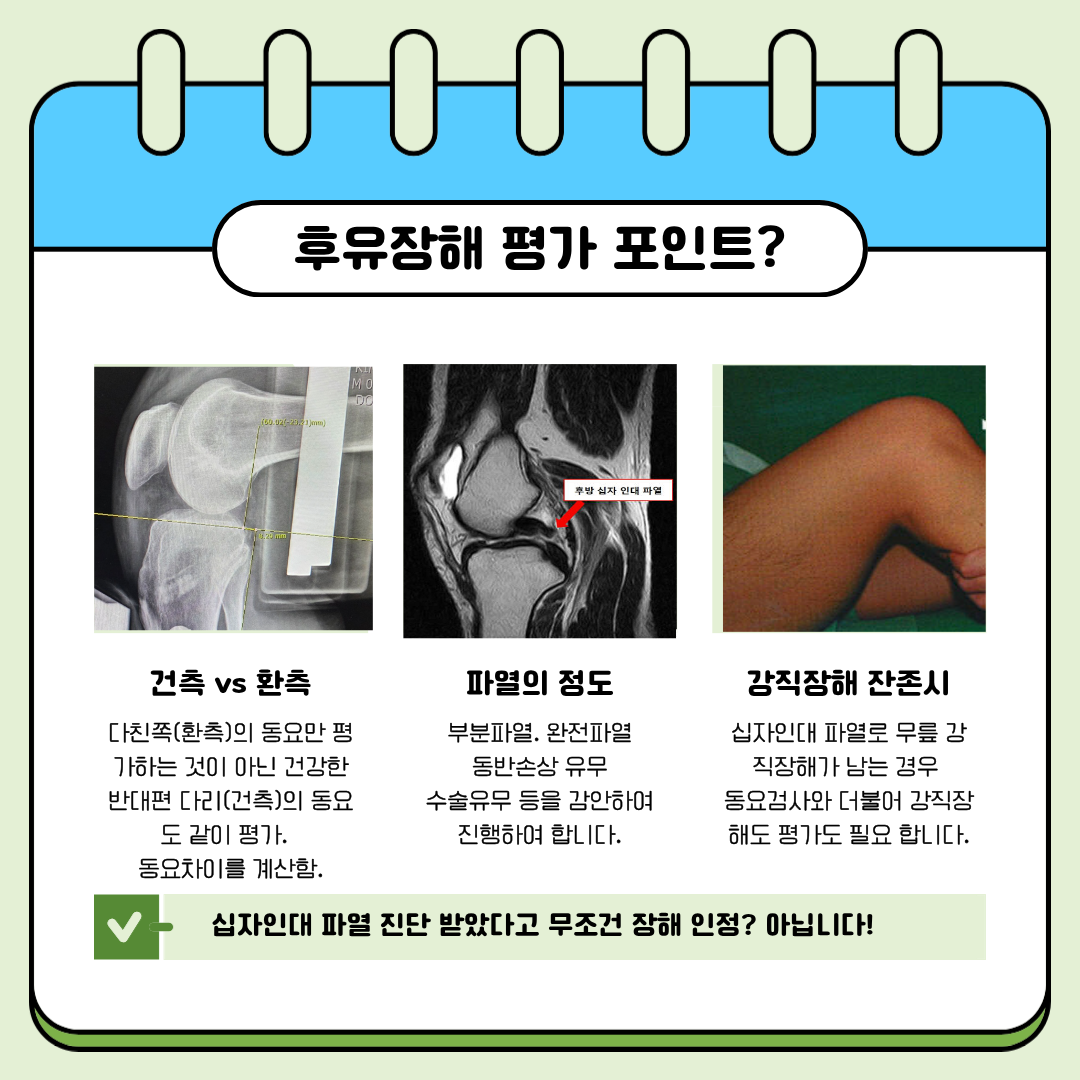 PCL rupture 파열 후유장해 보상포인트