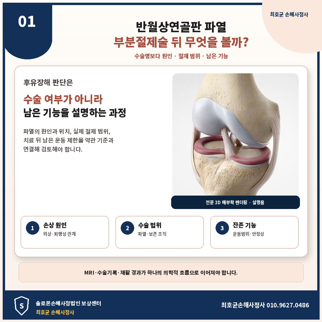 반월상연골판 파열 후유장해, 부분절제술 뒤 무엇을 판단할까?