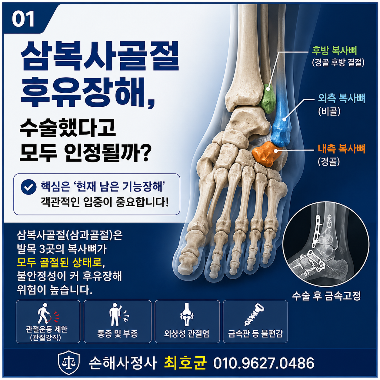 삼복사골절 후유장해진단서 어떻게 받아야 할까? 인정 핵심포인트는?