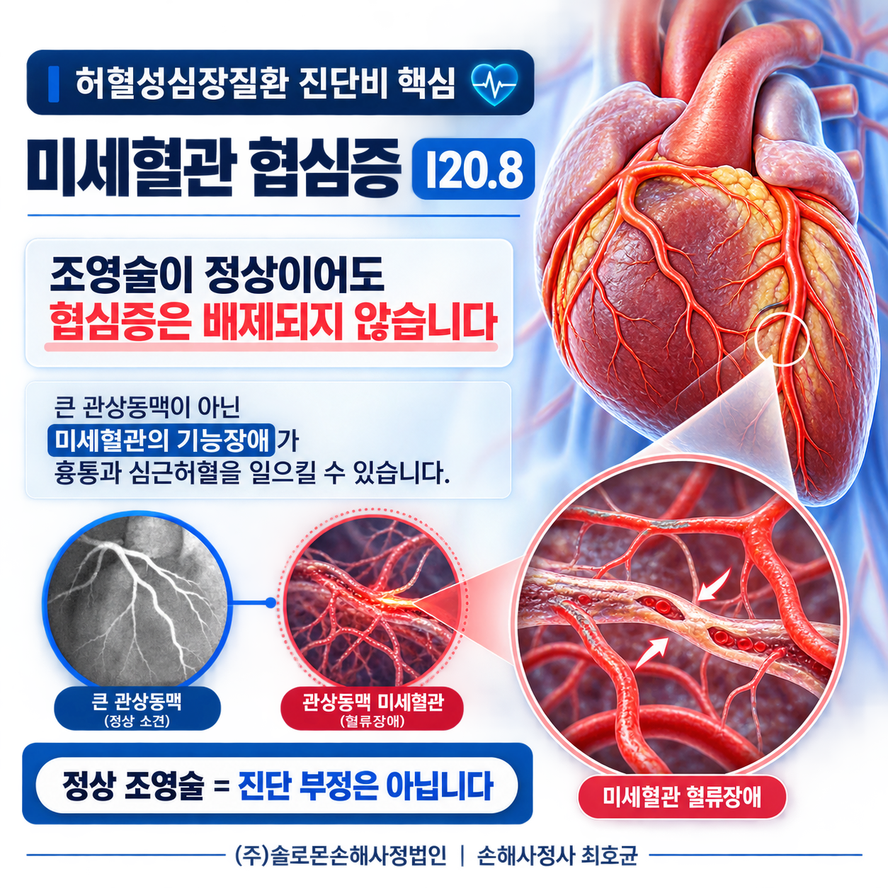 미세혈관 협심증 I20.8 허혈성심장질환 진단비가 거절되는 이유