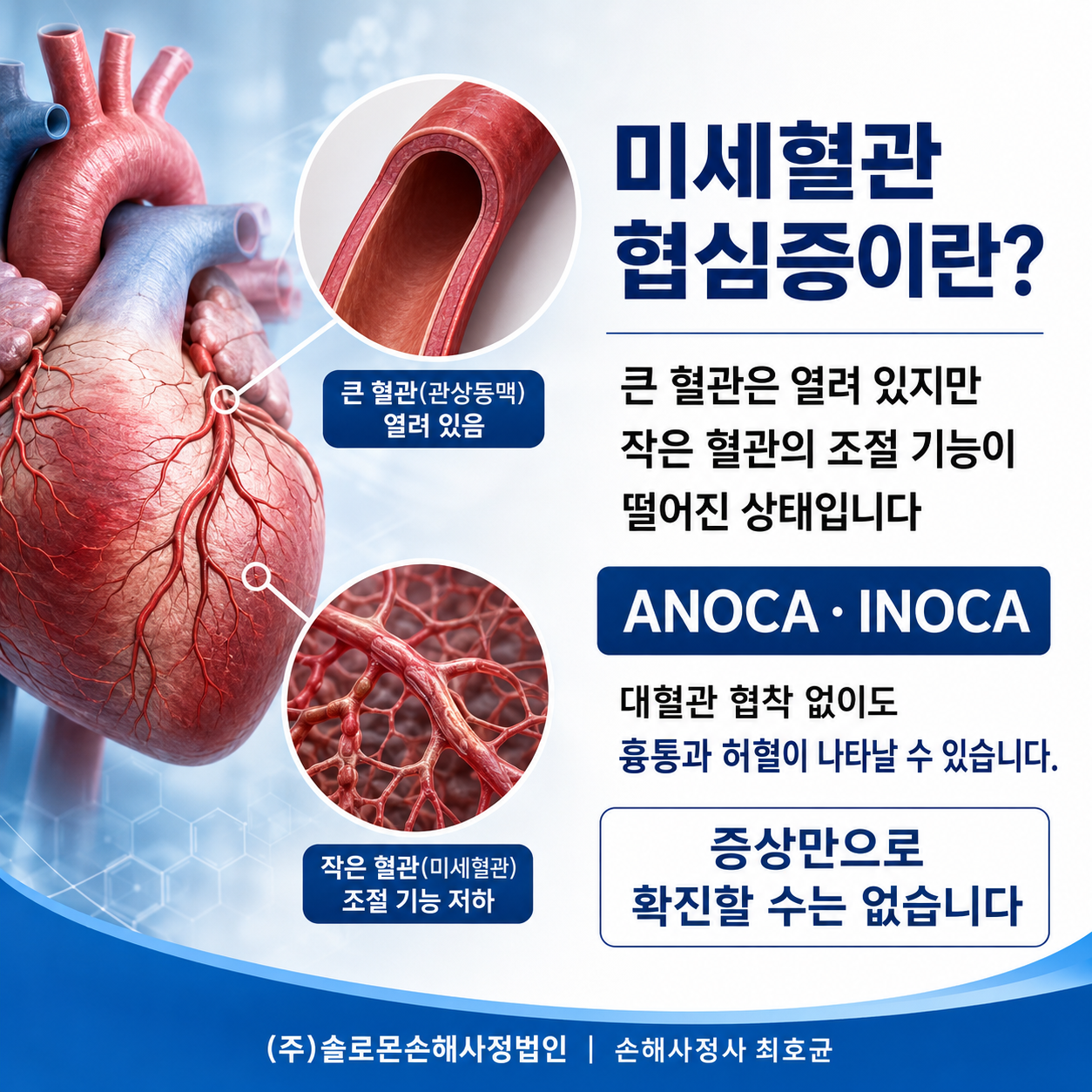 미세혈관 협심증 I20.8 허혈성심장질환 진단비가 거절되는 이유