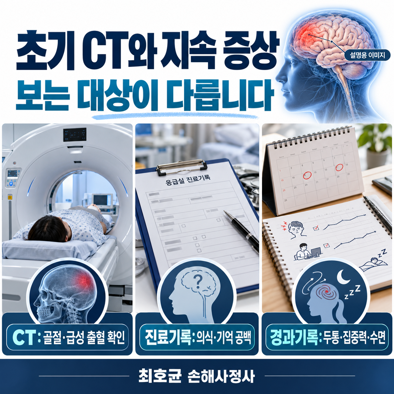 교통사고 뇌진탕 후 기억력 저하, CT가 정상이어도 후유장해 손해액은 어떻게 평가할까?
